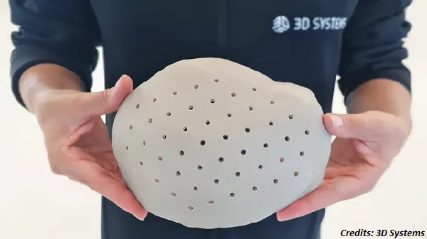 3D Systems' Patient-specific PEEK Cranial Implant Receives FDA Clearance