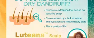 Microphyt Unveils Active to Target Dry Dandruff, Leaving Scalp Healthier & Revitalized