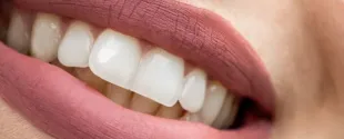 Kuraray Noritake's Dental Adhesive Receives Top Product Award
