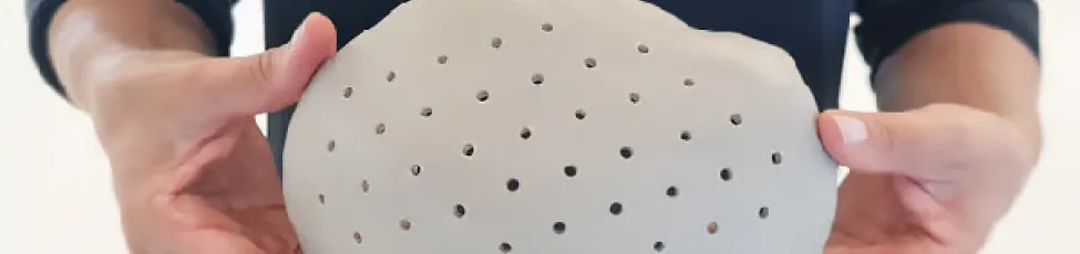 3D Systems' Patient-specific PEEK Cranial Implant Receives FDA Clearance